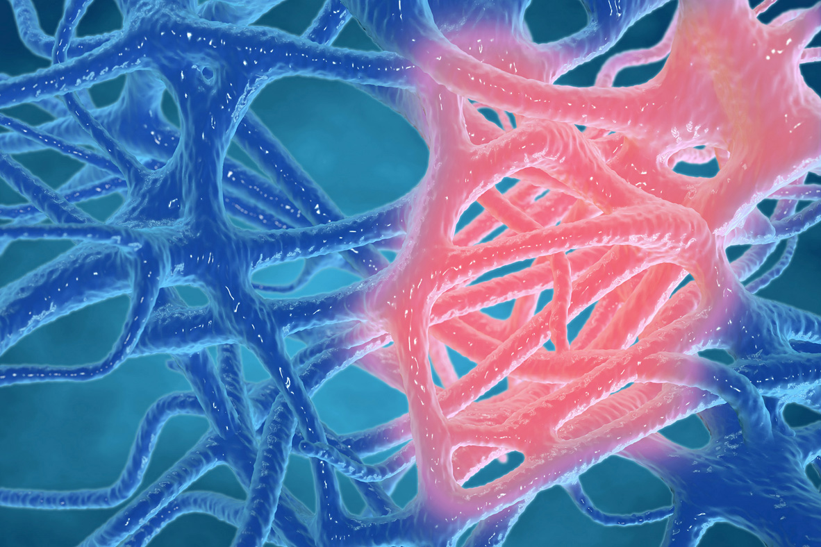 The Evidence on Milk Products on Inflammation Dairy Nutrition Canada